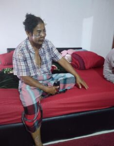 Diduga Pembiaran Penanganan Kasus Pengeroyokan Penganiyaan Anwar Gayo Pengusa Kopiopi Di Desa Warnasari