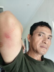 Diduga Arogan Pemilik Rumah Makan Kampoeng Gombong Keruarganya B Jadi Korban